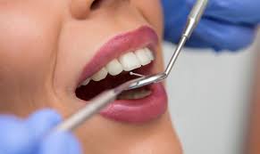 Ultimate Guide To Choosing The Right Dentist